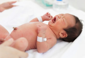 hernia umbilical en bebé